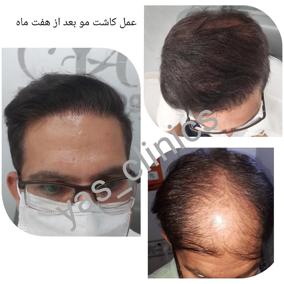 کلینیک یاس کرمانشاه +|نقد و بررسی دقیق به همراه تمام راه های ارتباطی|