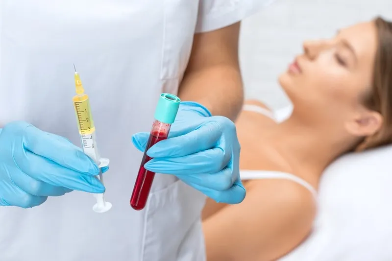 کیفیت پلاکت ها نیز نقش مهمی در منادگاری پی آر پی صورت دارند