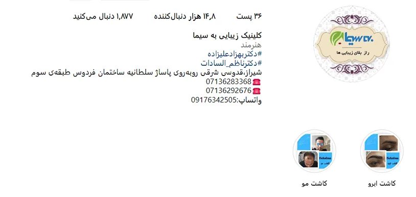 هزینه کاشت مو در شیراز تحت تاثیر عوامل مختلف و متنوعی قرار دارد.