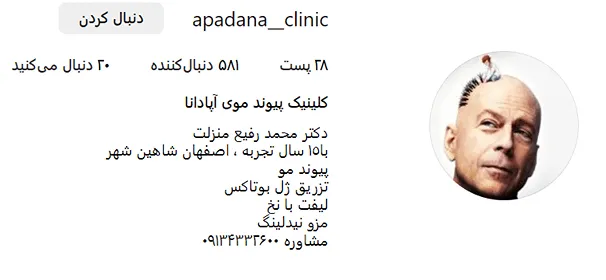 هزینه کاشت مو در اصفهان را عوامل متعددی تحت تاثیر خود قرار میدهد