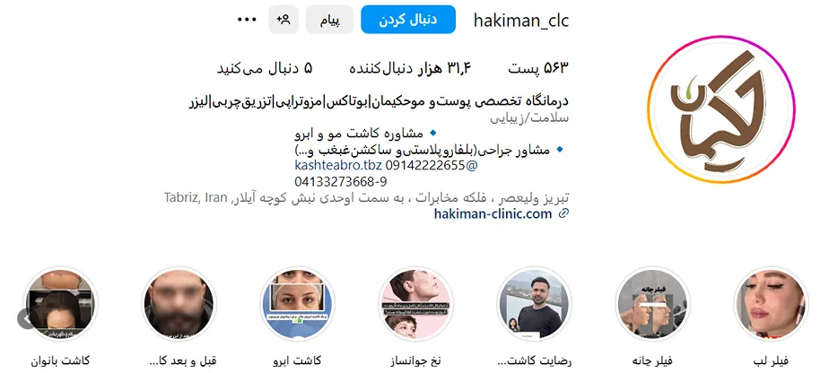 کلینیک حکیمان یکی از بهترین کلینیک بوتاکس در تبریز است