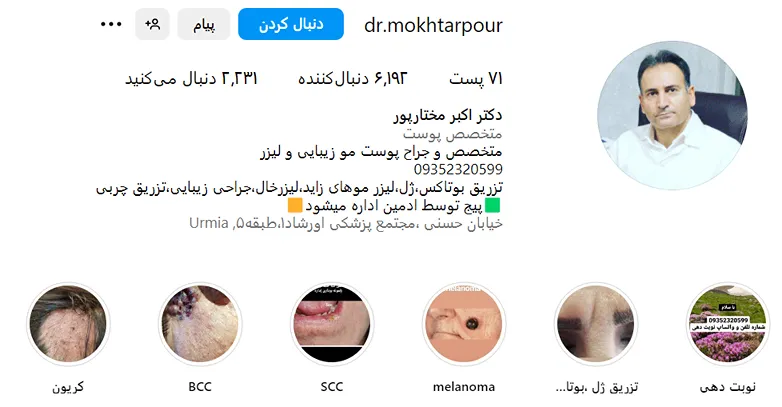 هزینه کاشت ابرو در ارومیه به عوامل مختلفی بستگی دارد