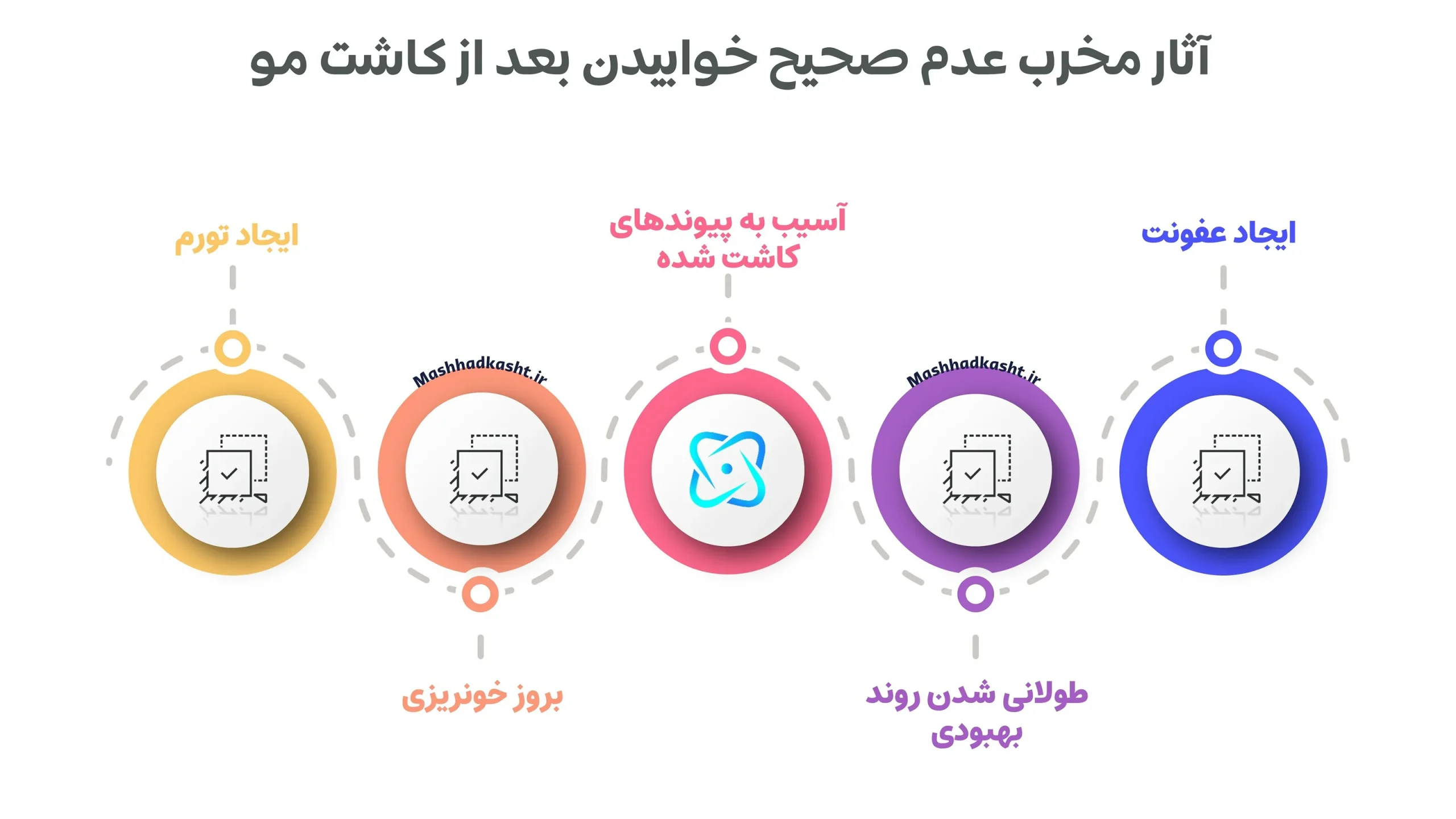 عوارض و نکات مربوط به نحوه خوابیدن بعد از کاشت مو
