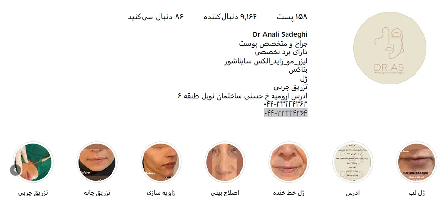 تصویر یکی از بهترین کلینیک کاشت ابرو در ارومیه را مشاهده میفرمایید.
