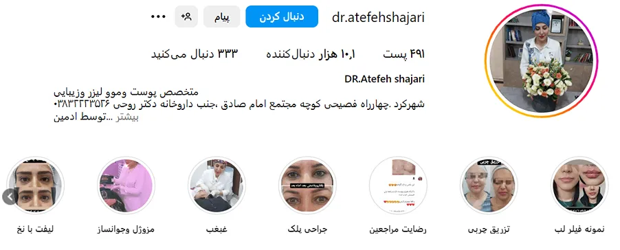 تصویر یکی دیگر از بهترین دکتر کاشت ابرو در شهرکرد را مشاهده میکنید.