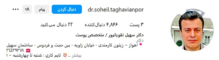 کاشت ابرو طبیعی در اهواز توسط بهترین متخصصین قابل انجام است