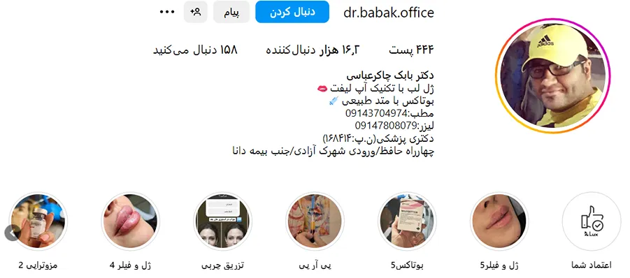 یکی از بهترین مرکز کاشت ابرو در اردیل را میتوانیددر این تصویر مشاهده بفرمایید