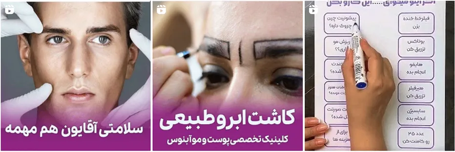 تصویر یکی از بهرتین مرکز کاشت ابرو در مشهد را مشاهده میفرمایید.