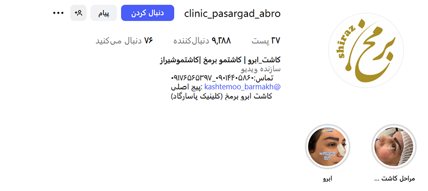 کاشت ابرو در اراک در کلینیک زیبایی برمخ کاملا قابل انجام است