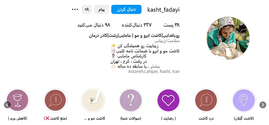 کاشت ابرو رشت در نزد رویا فدایی کاملا قابل انجام است