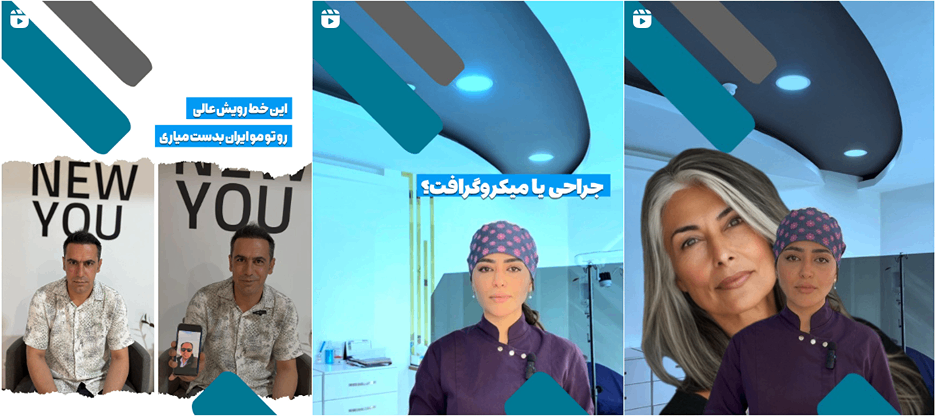 نمونه کار یکی از بهترین کلینیک کاشت ابرو در اراک را مشاهده میفرمایید.