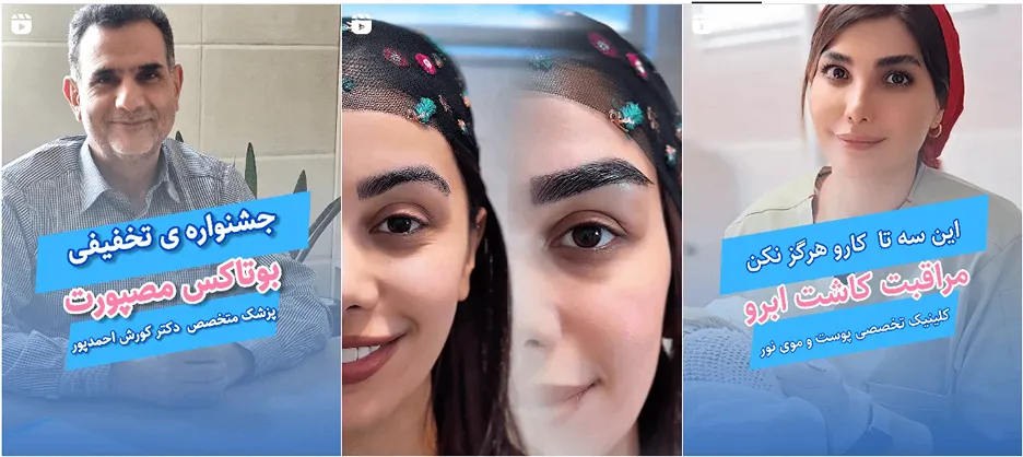 نمونه کار یکی از بهترین کاشت ابرو شهرکرد را مشاهده میفرمایید.