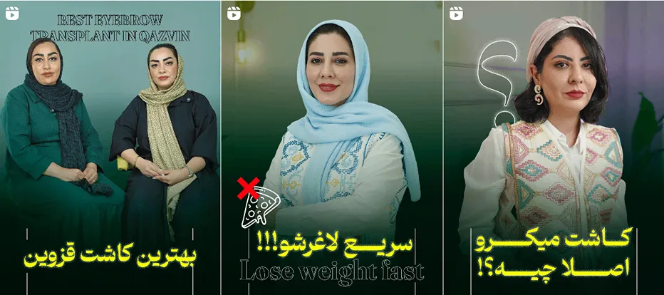 نمونه کار یکی از بهترین کلینیک کاشت ابرو در قزوین را مشاهده میفرمایید.