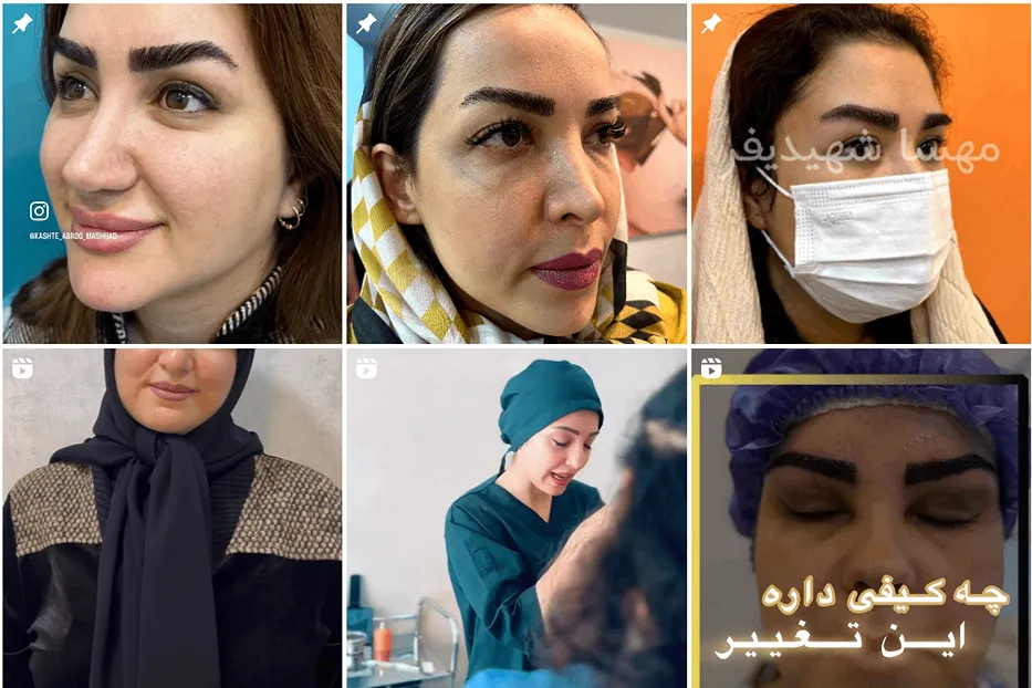 تصویر یکی از بهترین کلینیک کاشت ابرو در مشهد را مشاهده میفرمایید.