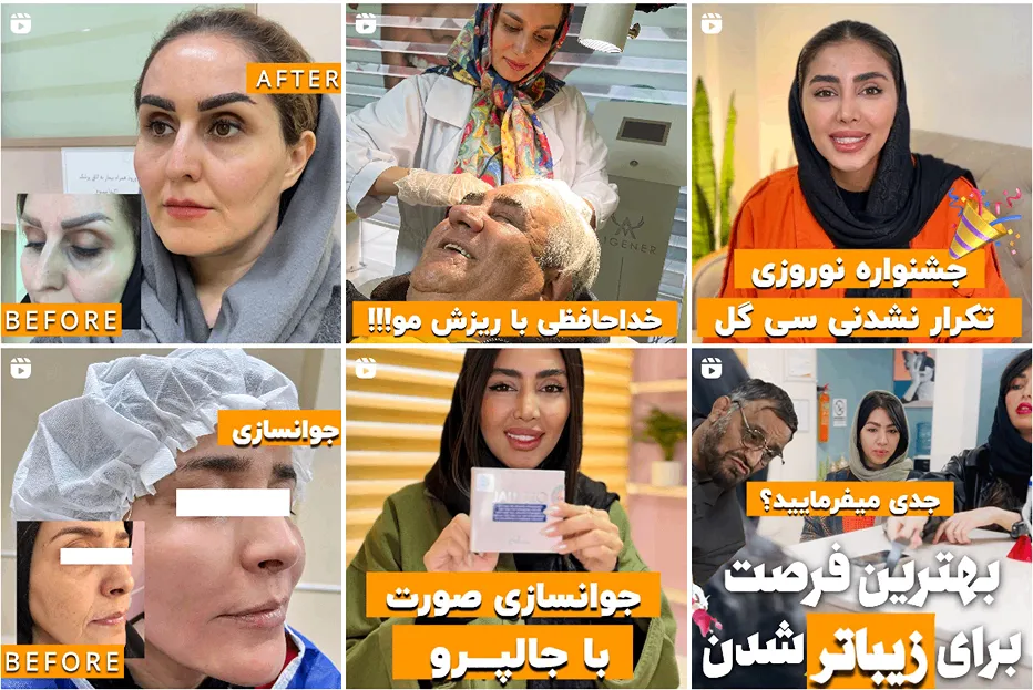 کاشت ابرو مشهد در کلینیک سی گل کاملا قابل انجام است