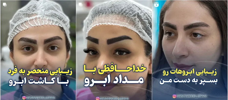 کاشت ابرو در ارومیه توسط خانم سیما اقایی کاملا قابل انجام است
