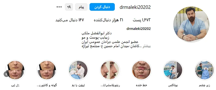 دکتر ملکی از بهترین دکتر بوتاکس در کاشان است