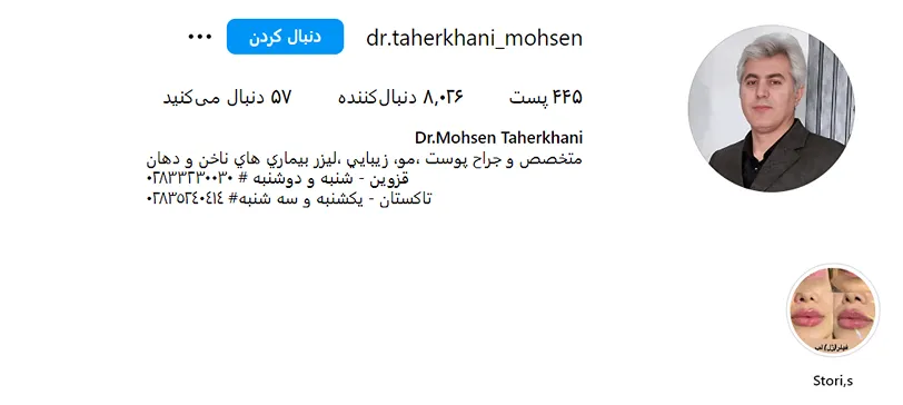 مزوتراپی در قزوین توسط دکتر محسن طاهرخانی کاملا قابل انجام است
