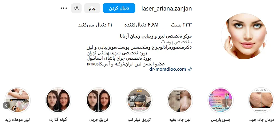 هزینه بوتاکس در زنجان به عوامل مختلفی وابسته است