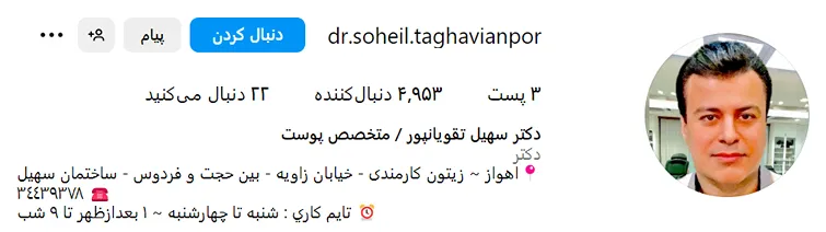 یکی از خدمات دکتر تقویانپور انجام بوتاکس در اهواز است