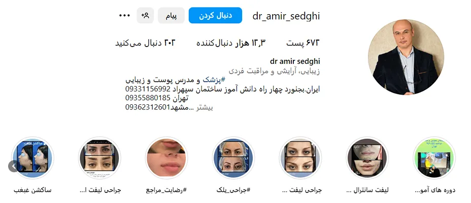 دکتر صدقی از بهترین دکتر بوتاکس در بجنورد است