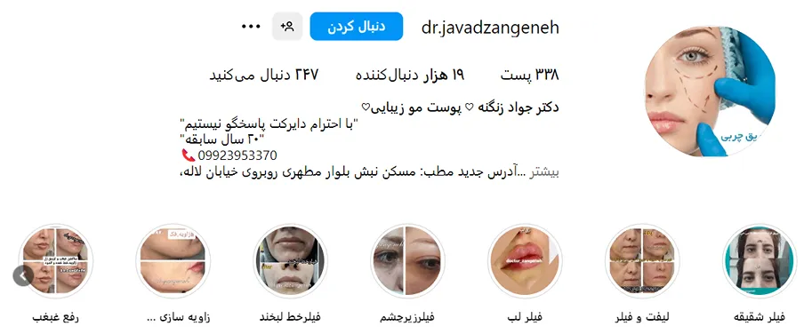 دکتر زنگنه از بهترین دکتر بوتاکس در کرمانشاه است