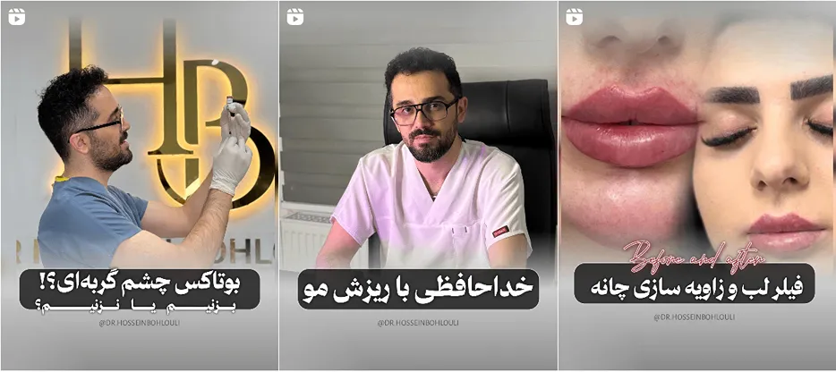 نمونه کار یکی دیگر از بهترین دکتر بوتاکس زنجان را مشاهده میفرمایید.