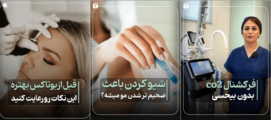 بوتاکس سنندج توسط دکتر دولتیابی کاملا قابل انجام است