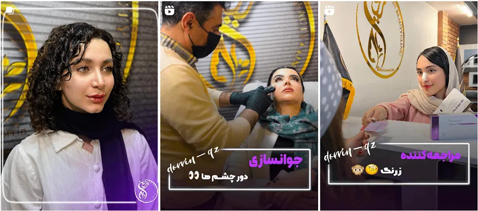 تزریق بوتاکس در قزوین در کلینیک زیبایی درین کاملا قابل انجام است