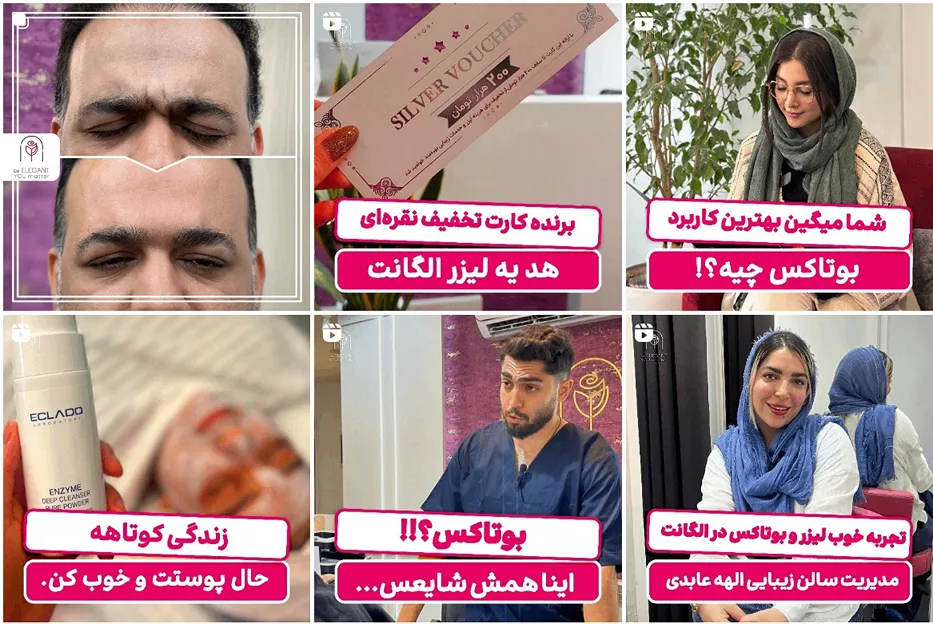 کلینیک زیبایی الگانت از بهترین کلینیک بوتاکس در ساری است