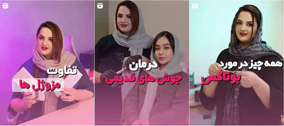 نمونه کار یکی دیگر از بهترین دکتر بوتاکس یزد را مشاهده میفرمایید.