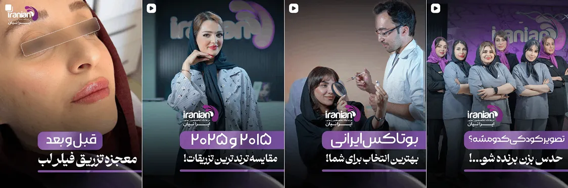 بوتاکس در تبریز در کلینیک زیبایی ایرانیان کاملا قابل انجام است