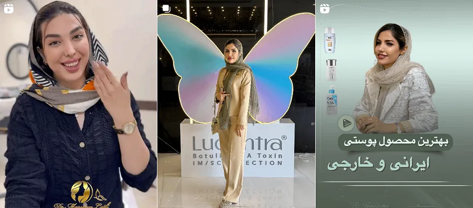 بوتاکس شهرکرد توسط دکتر لطفی کاملا قابل انجام است