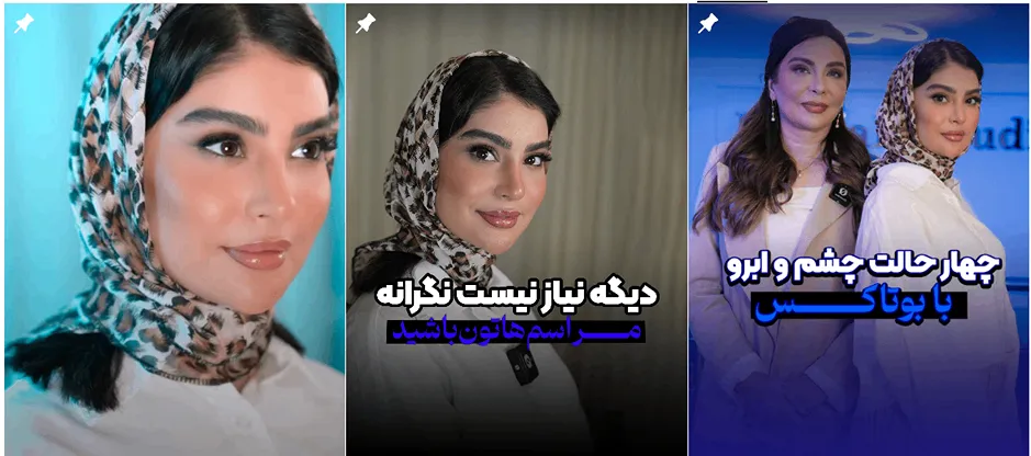 تزریق بوتاکس در یزد توسط دکتر محمودی کاملا قابل انجام است