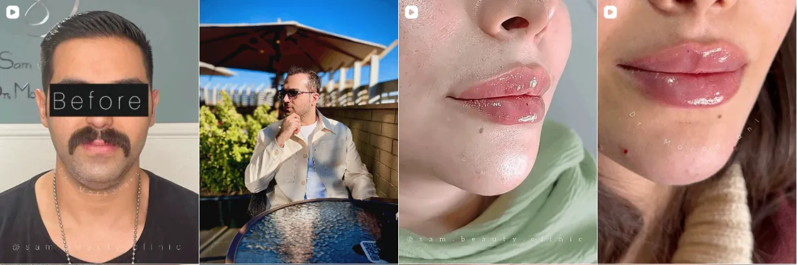 نمونه کار یکی از بهترین دکتر بوتکاس در همدان را مشاهده میفرمایید.