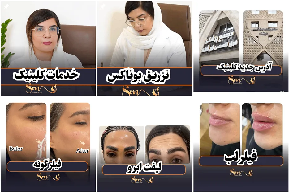 دکتر مروج از بهترین دکتر بوتاکس در ساری است