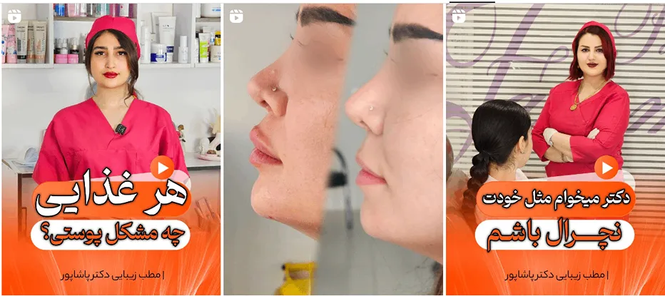 نمونه کار یکی از بهترین دکتر بوتاکس اردبیل را مشاهده میفرمایید.