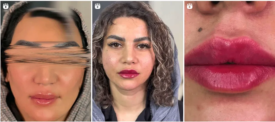 دکتر پورسهرابی از جمله بهترین دکترین کلینیک زیبایی کرمان است