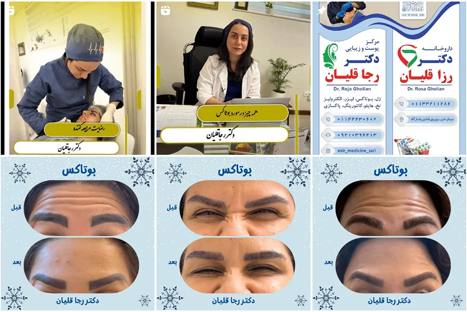 دکتر قلیان یکی از بهترین دکتر بوتاکس در ساری است