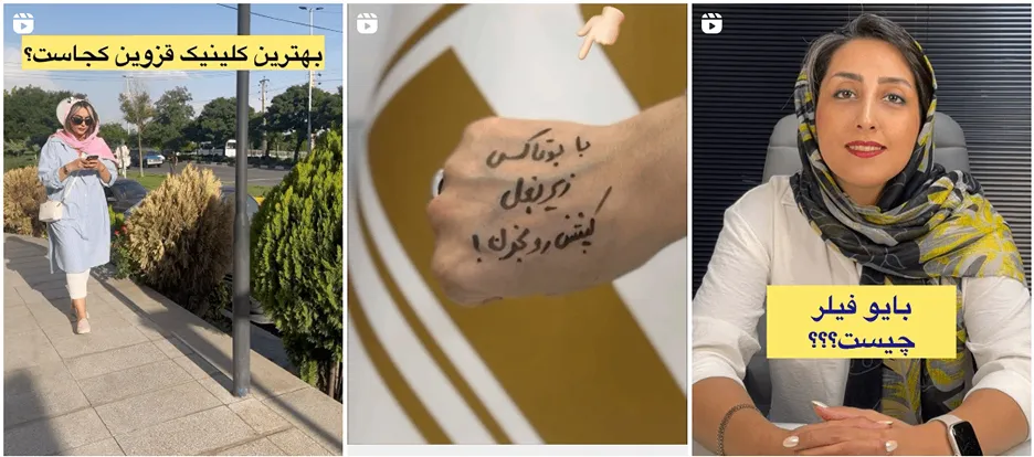 بهترین دکتر بوتاکس در قزوین در کلینیک زیبایی رونیک اماده خدمات رسانی به شما عزیزان است