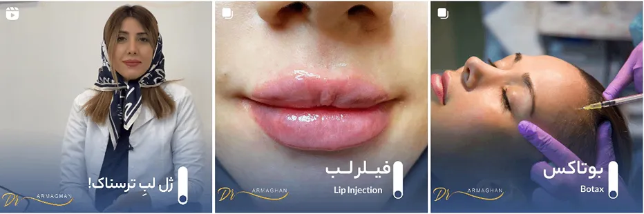 دکتر صادقی از بهترین دکتر تزریق ژل در مشهد است