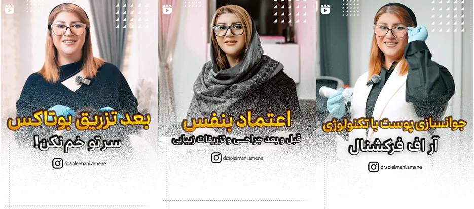 نمونه کار یکی از بهترین مراکزبوتاکس در اردبیل را مشاهده میفرمایید.