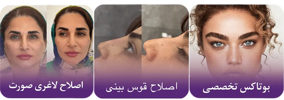 بوتاکس در سنندج توسط دکتر ویسی کاملا قابل انجام است