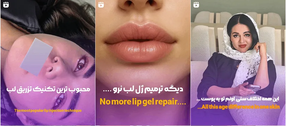 بوتاکس در یزد در کلینیک دکتر یوف زاده کاملا قابل انجام است