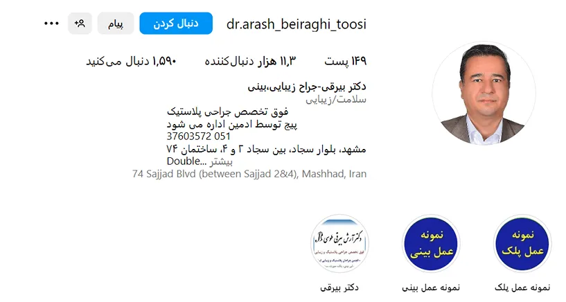 دکتر بیرقی یکی از بهترین جراح بلفاروپلاستی در مشهد است