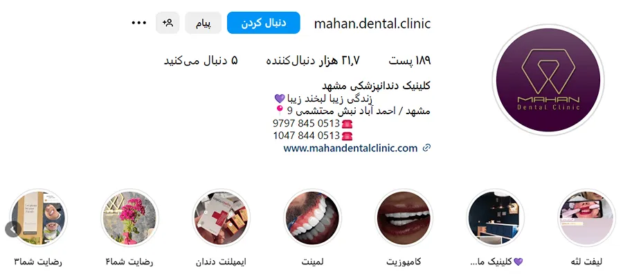 لمینت دندان در مشهد توسط کلینیک ماهان قابل انجام است