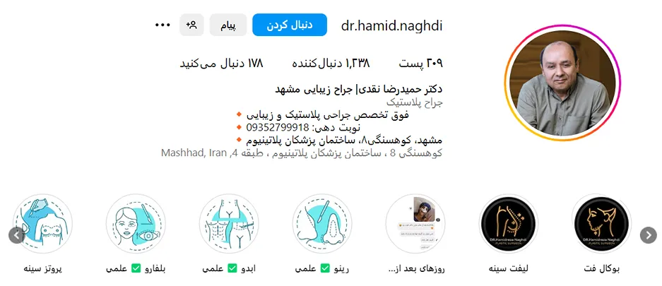 دکتر نقدی از بهترین دکتر بوکال فت در مشهد است