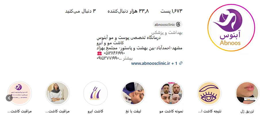 کاشت مو اقساطی مشهد در کلینیک آبنوس قابل انجام است