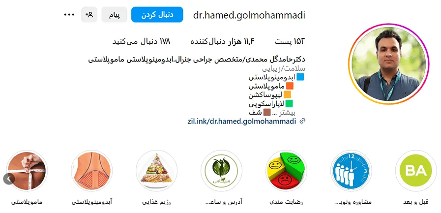 عمل ماموپاستی در مشهد توسط دکتر گل محمدی قابل انجام است