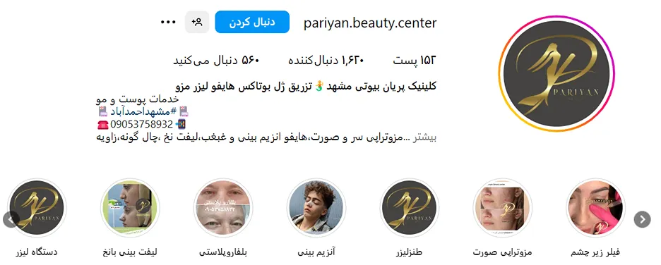 بلفاروپلاستی در مشهد در کلینیک زیبایی پریان قابل انجام است